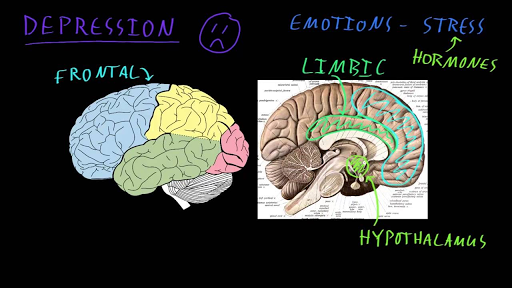 Anatomy Of Depression - Anatomical Charts & Posters