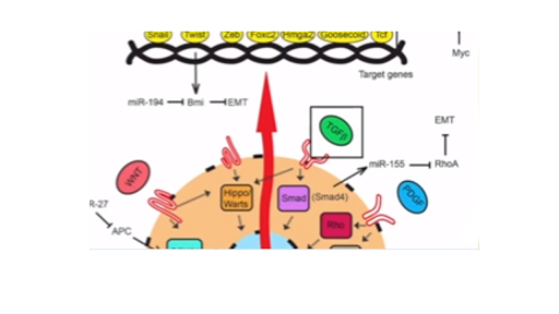 A Novel Form Of Cancer Therapy Targeting Metastatic Emt Video Khan Academy