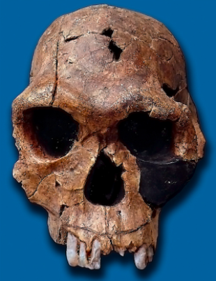 Picture of a _Homo habilis_ skull on a blue background. Skull is missing two of its front teeth.