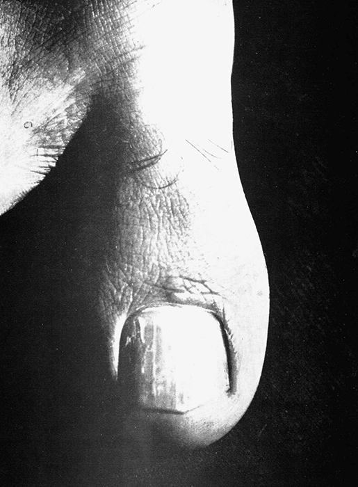 Jacques-André Boiffard, Big Toe, published in Documents 6 (November 1929)