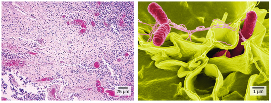 Images of Salmonella bacteria taken via light microscopy and scanning electron microscopy. Much more detail can be seen in the scanning electron micrograph.