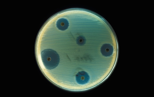 Staphylococcus, Description, Characteristics, Diseases, & Antibiotic  Resistance