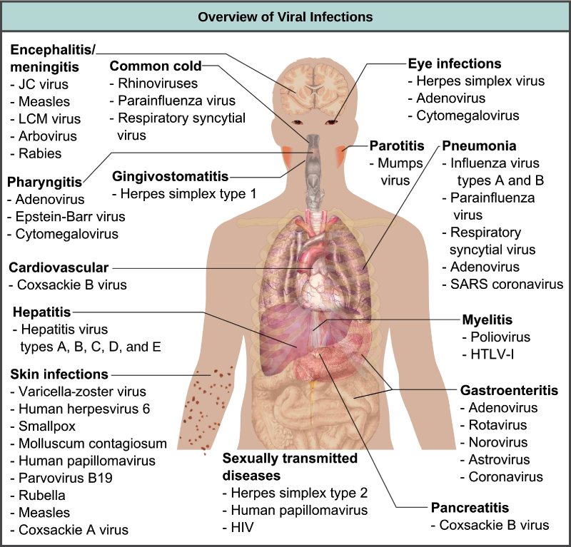 virus examples