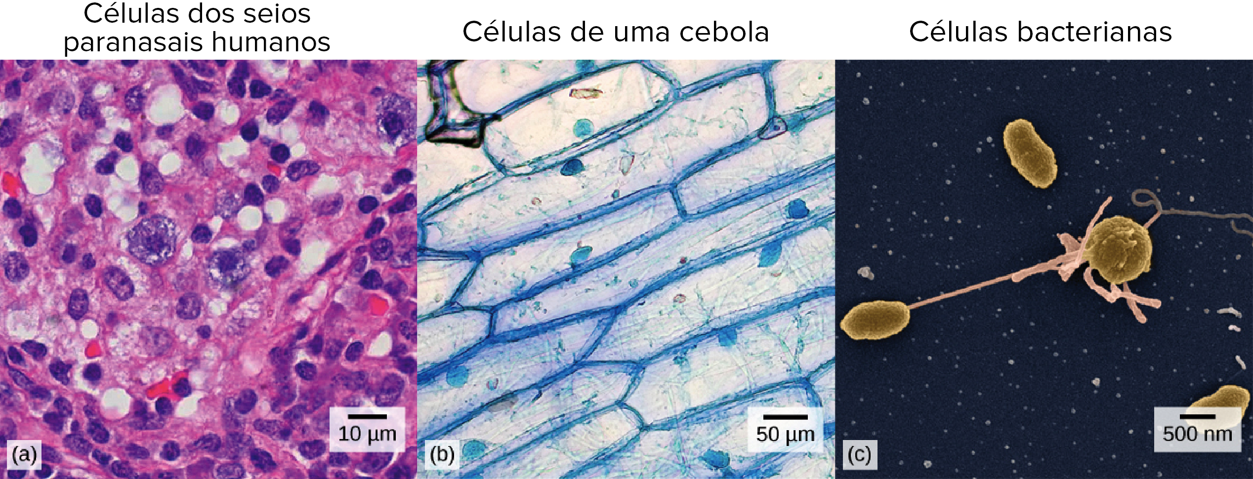 Microfotografias de células humanas, de cebolas e bacterianas.